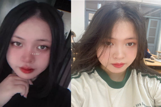 nu-sinh-hang-mup-chich-nhau-bet-nhe